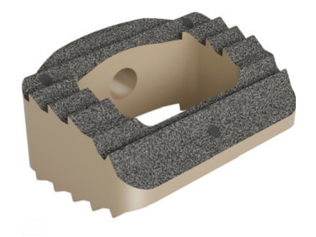 Cage/cervical spacers PEEK